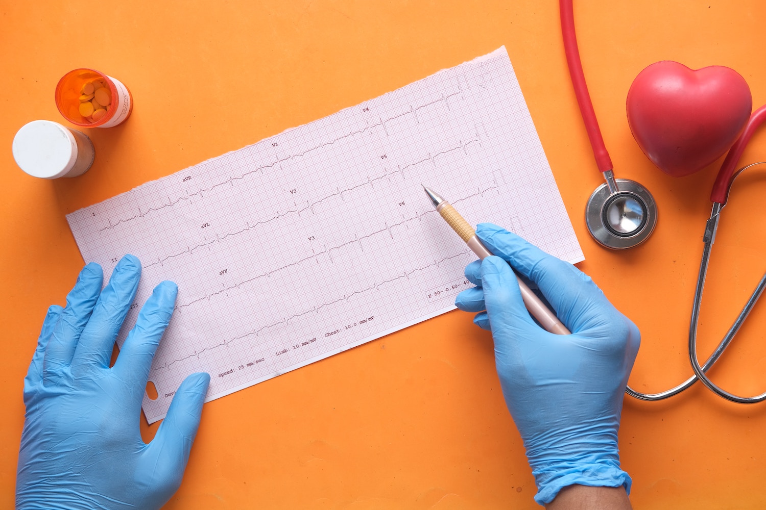 Kardiologiczny  detektyw - czy holter wykryje nerwicę?
